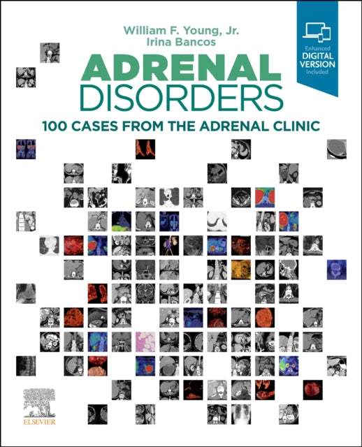Book cover of: Adrenal Disorders. By: Young, William F., Jr.