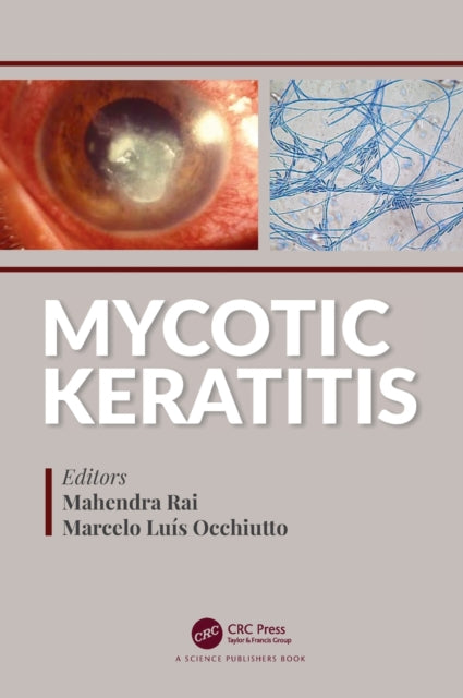 Book cover of: Mycotic Keratitis. By: Mahendra Rai