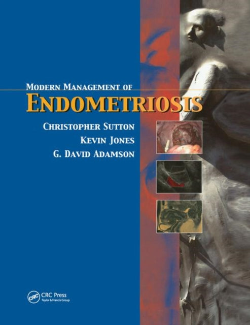 Book cover of: Modern Management of Endometriosis. By: C. J. G. Sutton