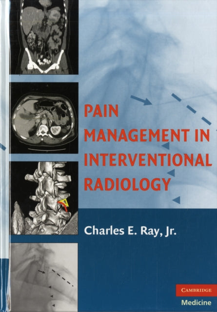 Book cover of: Pain Management in Interventional Radiology. By: Jr., Charles E. Ray