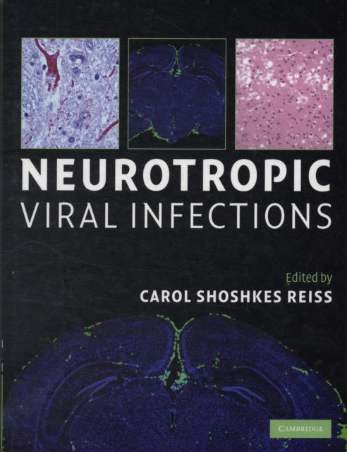 Book cover of: Neurotropic Viral Infections