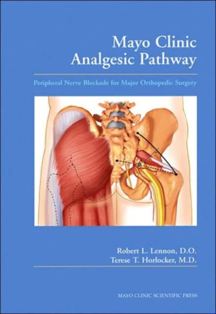 Book cover of: Mayo Clinic Analgesic Pathway. By: Robert L. Lennon