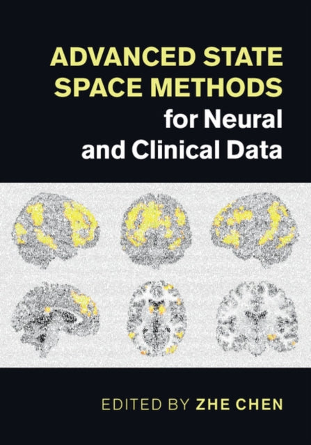 Book cover of: Advanced State Space Methods for Neural and Clinical Data. By: Zhe Chen