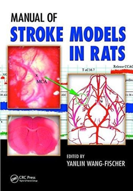 Book cover of: Manual of Stroke Models in Rats. By: Yanlin Wang-Fischer
