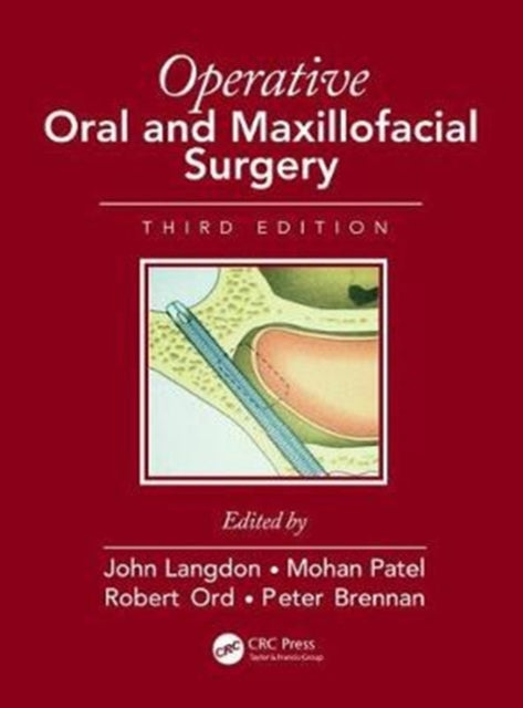 Book cover of: Operative Oral and Maxillofacial Surgery. By: J. D. Langdon