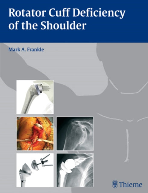 Book cover of: Rotator Cuff Deficiency of the Shoulder