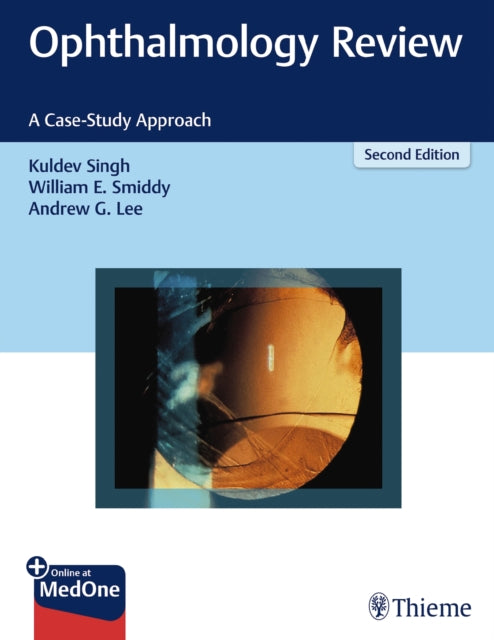 Book cover of: Ophthalmology Review. By: Kuldev Singh