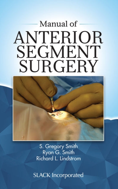 Book cover of: Manual of Anterior Segment Surgery. By: S. Gregory Smith