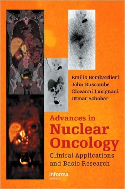 Book cover of: Advances in Nuclear Oncology:
