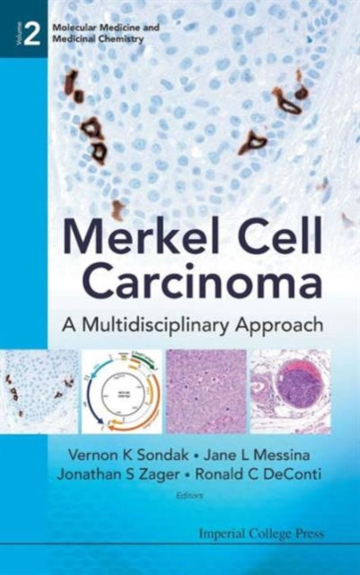 Book cover of: Merkel Cell Carcinoma: A Multidisciplinary Approach. By: Sondak