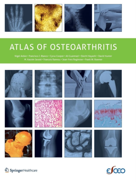 Book cover of: Atlas of Osteoarthritis. By: Nigel Arden