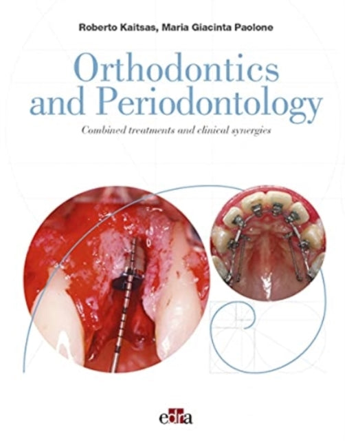 Book cover of: Orthodontics and Periodontology. By: Roberto Kaitsas
