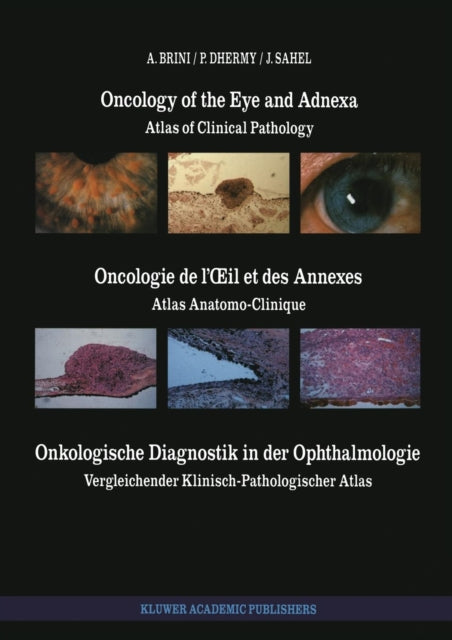 Book cover of: Oncology of the Eye and Adnexa / Oncologie de l’Œil et des Annexes / Onkologische Diagnostik in der Ophthalmologie. By: A. Brini