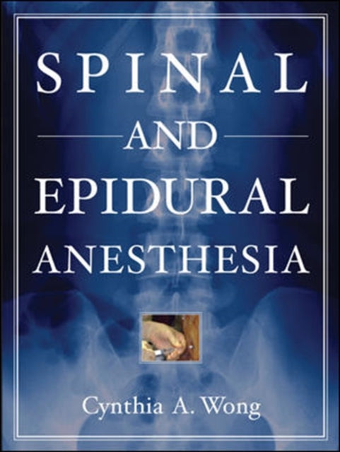Book cover of: Spinal and Epidural Anesthesia. By: Cynthia A. Wong, Cynthia Wong