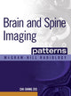 Book cover of: Brain and Spine Imaging Patterns. By: Chi S. Zee