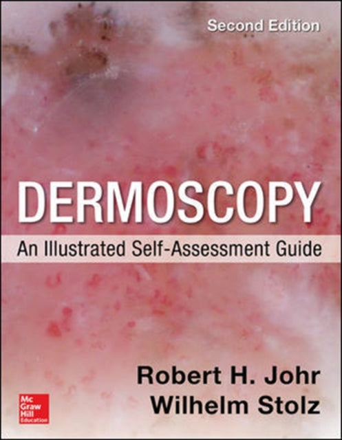 Book cover of: Dermoscopy: An Illustrated Self-Assessment Guide, 2/e. By: Robert H. Johr