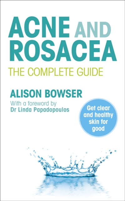 Book cover of: Acne and Rosacea. By: Alison Bowser