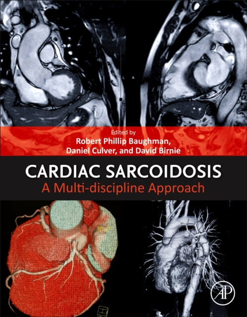 Book cover of: Cardiac Sarcoidosis. By: Robert Phillip Baughman