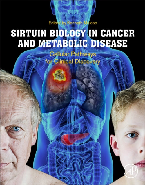 Book cover of: Sirtuin Biology in Cancer and Metabolic Disease. By: Kenneth Maiese