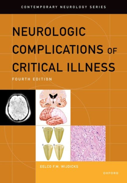 Book cover of: Neurologic Complications of Critical Illness. By: Eelco F. M. Wijdicks