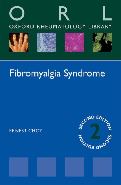 Book cover of: Fibromyalgia Syndrome. By: Ernest Choy