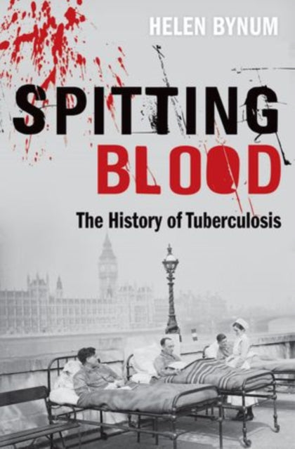 Book cover of: Spitting Blood. By: Helen Bynum