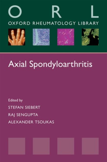 Book cover of: Axial Spondyloarthritis. By: Stefan Siebert