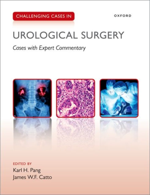Book cover of: Challenging Cases in Urological Surgery. By: Karl Pang