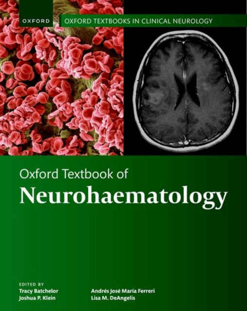 Book cover of: Oxford Textbook of Neurohaematology. By: Tracy Batchelor
