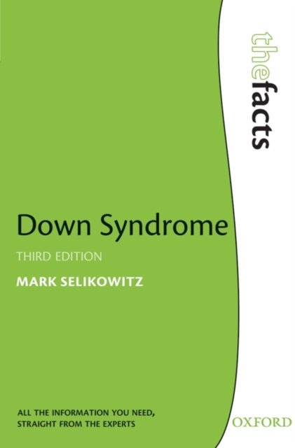 Downi sündroom