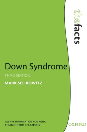 Downi sündroom