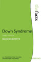 Downi sündroom