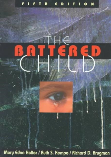 Book cover of: Battered Child