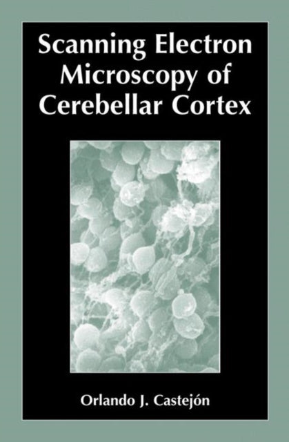 Book cover of: Scanning Electron Microscopy of Cerebellar Cortex. By: Orlando Castejón