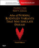 Normaalsete röntgenivariantide atlas, mis võivad haigust simuleerida