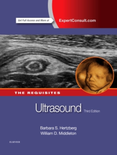 Book cover of: Ultrasound: The Requisites. By: Barbara S. Hertzberg MD  FACR