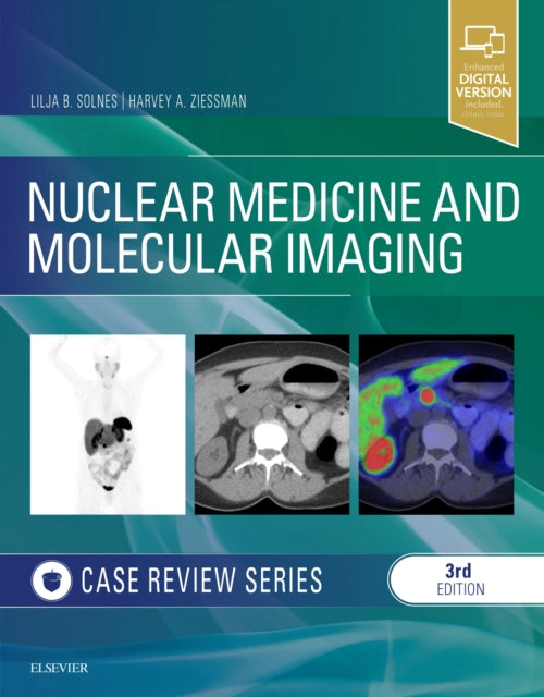 Book cover of: Nuclear Medicine and Molecular Imaging: Case Review Series. By: Lilja B. Solnes