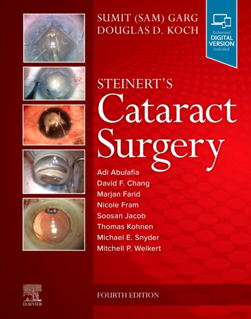Book cover of: Steinert's Cataract Surgery. By: Sumit Garg