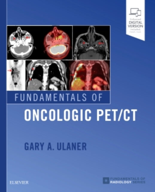 Book cover of: Fundamentals of Oncologic PET/CT. By: Gary A. Ulaner