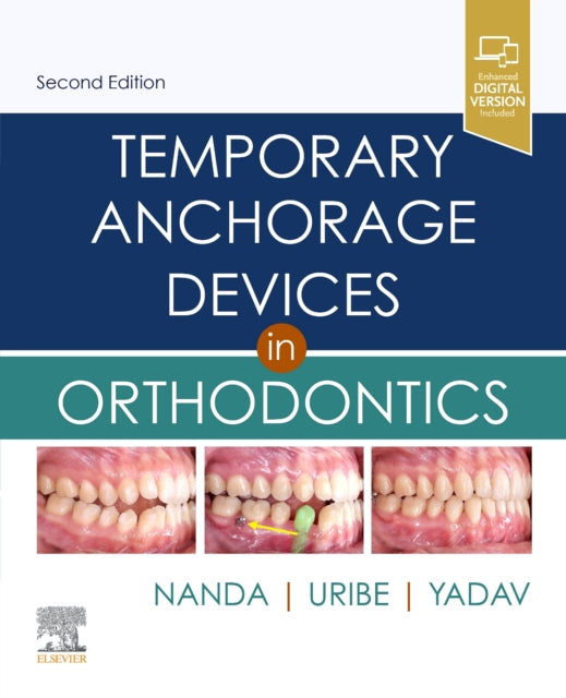 Book cover of: Temporary Anchorage Devices in Orthodontics. By: Ravindra Nanda