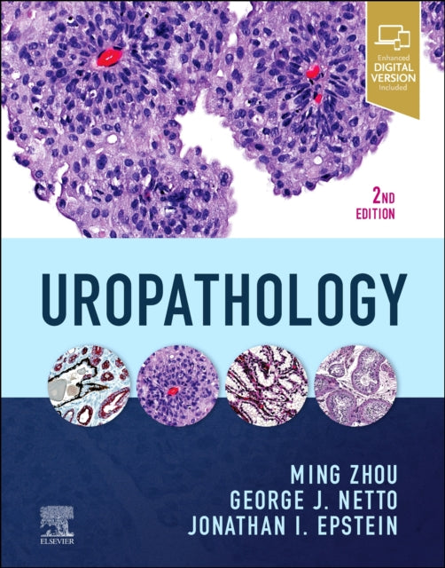 Book cover of: Uropathology. By: Ming Zhou MD  PhD