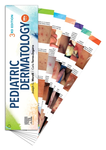 Book cover of: Pediatric Dermatology DDX Deck. By: Joseph G. Morelli
