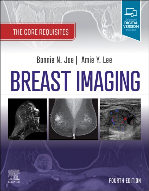 Book cover of: Breast Imaging. By: Bonnie N. Joe