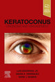 Book cover of: Keratoconus. By: Luis Izquierdo