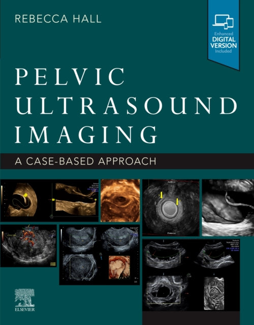 Book cover of: Pelvic Ultrasound Imaging. By: Rebecca Hall