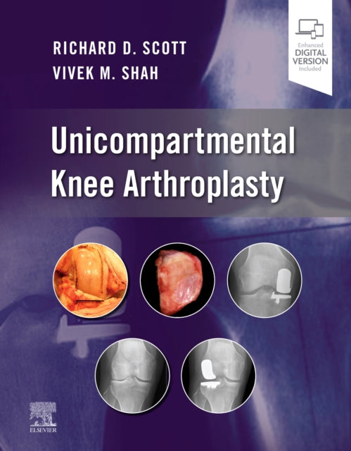 Book cover of: Unicompartmental Knee Arthroplasty. By: Richard D. Scott