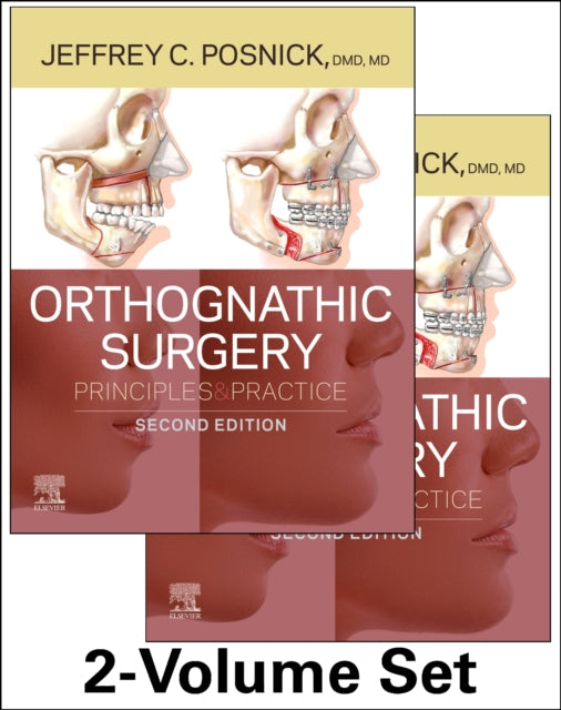 Book cover of: Orthognathic Surgery - 2 Volume Set. By: Jeffrey C. Posnick