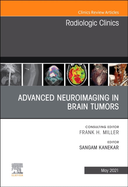 Book cover of: Advanced Neuroimaging in Brain Tumors, An Issue of Radiologic Clinics of North America. By: Sangam Kanekar