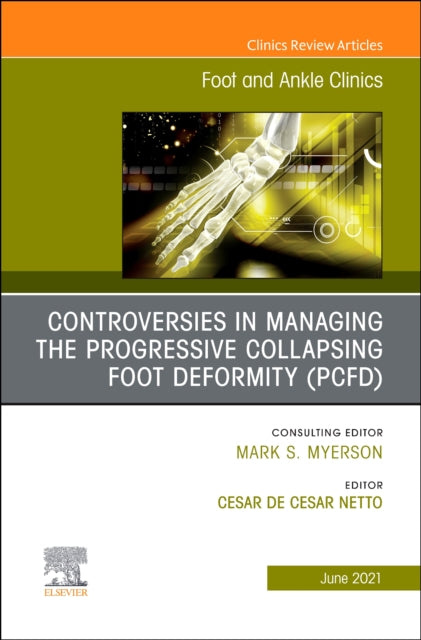 Book cover of: Controversies in Managing the Progressive Collapsing Foot Deformity (PCFD), An issue of Foot and Ankle Clinics of North America. By: Cesar de Cesar Netto