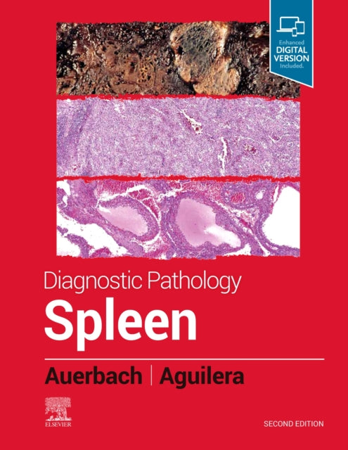 Book cover of: Diagnostic Pathology: Spleen. By: Aaron Auerbach